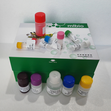 人基质金属蛋白酶2(MMP2)试剂盒